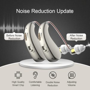 Hearing AIDS With A Pair Of Headphones, Digital Charging Hearing AIDS For The Elderly With Noise Cancellation Function, Hearing Aid Equipment For Hearing Loss