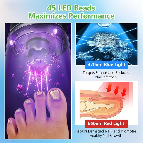KTS Laser Device For Toenail Fungus Treatment- 15x 470nm Blue Light & 30x 650nm Red Light Therapy | Treats All Affected Nails At Once | Home Use - Image 2