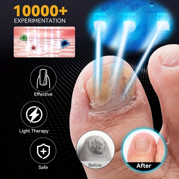 KTS Nail Fungus Cleaning Device For Multiple Toenails & Fingernails, Foldable Nail Fungus Light Treatment Device, Suitable For Discolored And Thickened Toenails Home Use (White) - Image 6